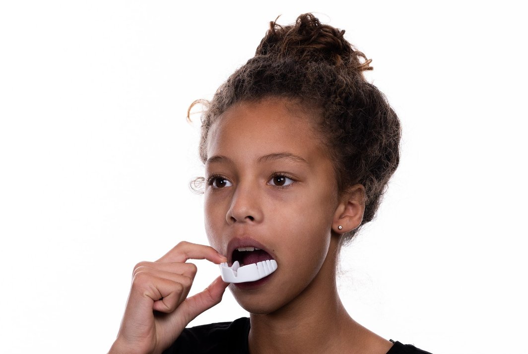 SNAP FIT|熱成形が必要のないマウスピース